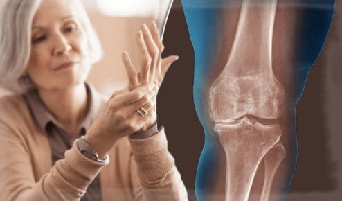 ����� ����� 55: ��� �� ����� � ���� ������� ��������