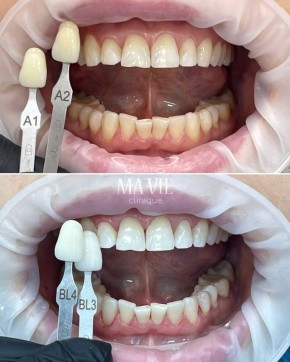 ������ ����: �� ������ ������������ ��������, �� � ������ ��������