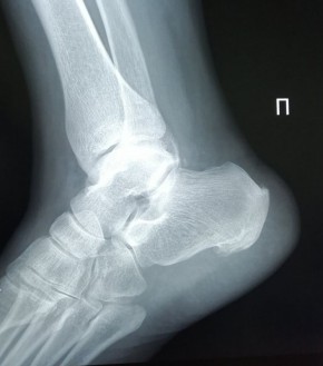 ��� �������� ���������� �������: ������������ ������ � ����������� ��������