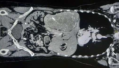 ������� ����� �������� � ���� �������� ������ ��������� �����