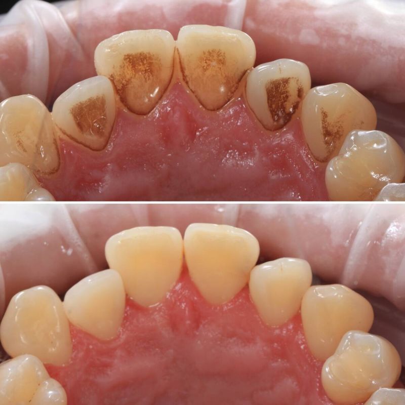 ��� �������� ������ �� �����: ������� �������� ������