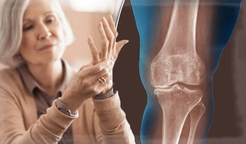 ����� ����� 55: ��� �� ����� � ���� ������� ��������