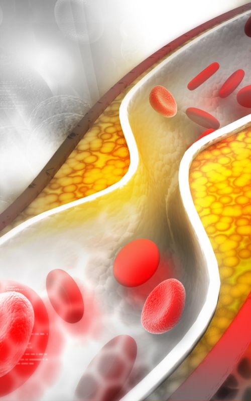 Шишонин о статинах: истина и мифы о холестерине